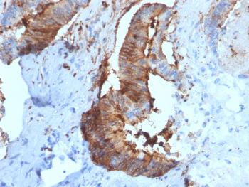 Anti-Cathepsin D (Tumor Marker) Monoclonal Antibody(Clone: CTSD/2781)