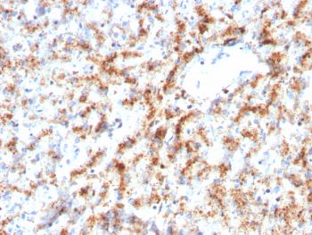 Anti-Cathepsin D (Tumor Marker) Monoclonal Antibody(Clone: CTSD/3082)