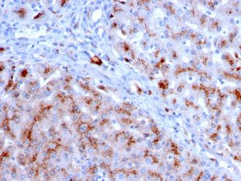 Anti-Cathepsin D (Tumor Marker) Monoclonal Antibody(Clone: CTSD/3083)