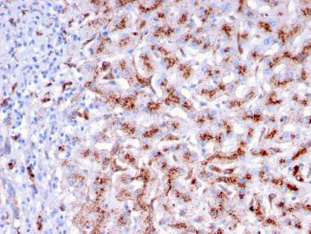 Anti-Cathepsin D (Tumor Marker) Monoclonal Antibody(Clone: CTSD/3276)