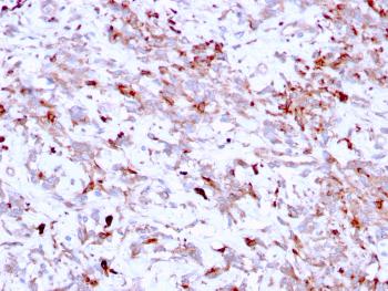 Anti-Cathepsin K (Marker of Tumor Invasiveness) Monoclonal Antibody(Clone: CTSK/2791)