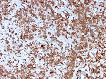 Anti-Cathepsin K (Marker of Tumor Invasiveness) Monoclonal Antibody(Clone: CTSK/2792)