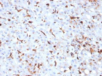 Anti-Cathepsin K (Marker of Tumor Invasiveness) Monoclonal Antibody(Clone: CTSK/2793)