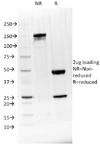 Anti-BTLA Monoclonal Antibody(Clone: BTLA/1528)