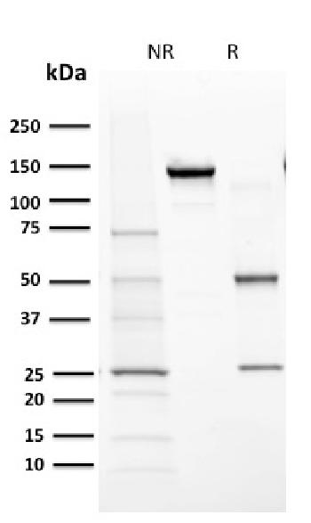 Anti-Cytochrome P450 1A1/1A2 Monoclonal Antibody(Clone: MC1)