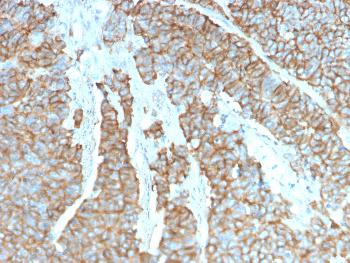 Anti-Drebrin 1 (DBN1) Monoclonal Antibody(Clone: DBN1/3393)