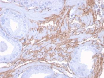 Anti-Decorin Monoclonal Antibody(Clone: DCN/3523)