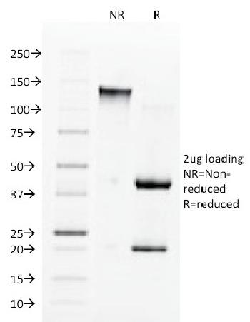 Anti-Angiotensin I Converting Enzyme (ACE) / CD143 Monoclonal Antibody(Clone: 9B9)