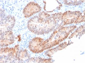 Anti-Aldo-keto Reductase Family 1 Member C2 / DD2 Monoclonal Antibody(Clone: CPTC-AKR1C2-1)