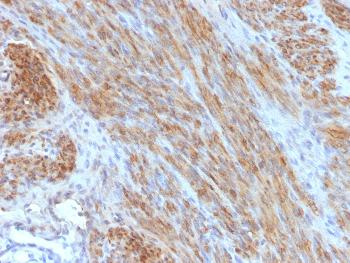 Anti-Desmin (Muscle Cell Marker) Monoclonal Antibody(Clone: DES/1711)