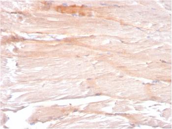 Anti-Dystrophin (DMD) (Marker of Duchenne and Becker Muscular Dystrophy) Monoclonal Antibody(Clone: DMD/3241)