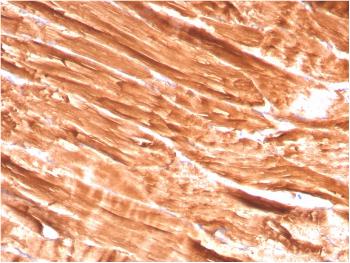 Anti-Dystrophin (DMD) (Marker of Duchenne and Becker Muscular Dystrophy) Monoclonal Antibody(Clone: DMD/3242)