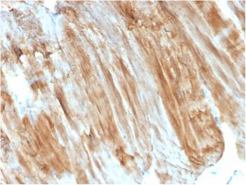 Anti-Dystrophin (DMD) (Marker of Duchenne and Becker Muscular Dystrophy) Monoclonal Antibody(Clone: DMD/3243)