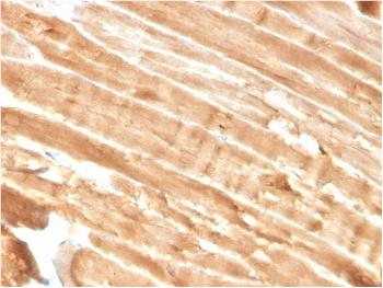 Anti-Dystrophin (DMD) (Marker of Duchenne and Becker Muscular Dystrophy) Monoclonal Antibody(Clone: DMD/3244)