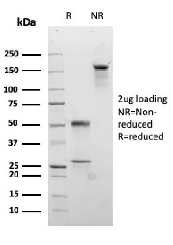 Anti-Desmocollin-2/3 Monoclonal Antibody(Clone: rDSC2/3437)