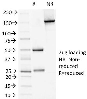 Anti-Desmoglein-1 (DSG1) Monoclonal Antibody(Clone: 18D4)