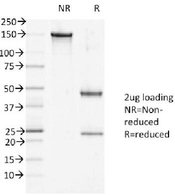 Anti-Desmoglein-1 (DSG1) Monoclonal Antibody(Clone: 27B2)