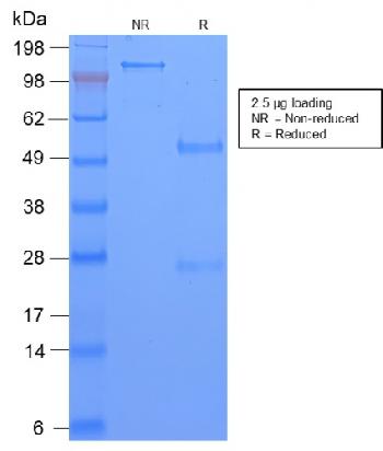 Anti-TAG-72 / CA72.4 (Tumor-Associated Glycoprotein) Monoclonal Antibody(Clone: CA72/2869R)