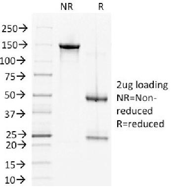 Anti-Desmoglein-2 (DSG2) Monoclonal Antibody(Clone: 6D8)