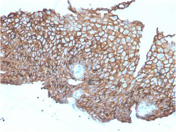 Anti-Desmoglein-3 (Squamous Cell Marker) Monoclonal Antibody(Clone: DSG3/2840)