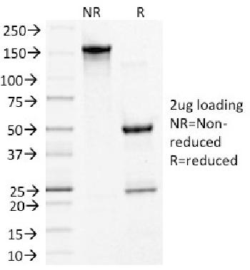 Anti-Desmoglein-3 (Squamous Cell Marker) Monoclonal Antibody(Clone: 5G11)