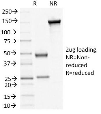 Anti-Desmoglein-3 (Squamous Cell Marker) Monoclonal Antibody(Clone: 5H10)