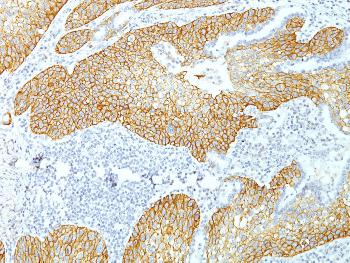 Anti-Desmoglein-3 (Squamous Cell Marker) Monoclonal Antibody(Clone: DSG3/1535)