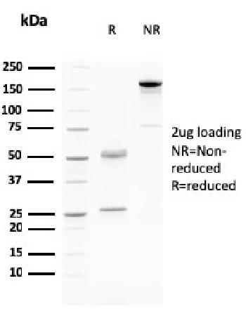 Anti-Desmoglein-3 (Squamous Cell Marker) Monoclonal Antibody(Clone: DSG3/2796)