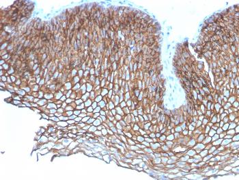 Anti-Desmoglein-3 (Squamous Cell Marker) Monoclonal Antibody(Clone: DSG3/2837)