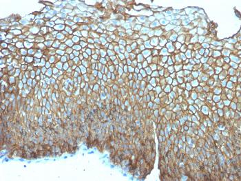 Anti-Desmoglein-3 (Squamous Cell Marker) Monoclonal Antibody(Clone: DSG3/2839)