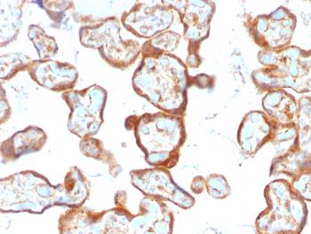 Anti-Thymidine Phosphorylase / PD-ECGF (Angiogenesis Marker) Monoclonal Antibody(Clone: SPM322)