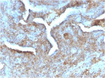 Anti-Thymidine Phosphorylase / PD-ECGF (Angiogenesis Marker) Monoclonal Antibody(Clone: TYMP/2890R)