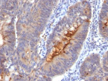 Anti-Secretory Component / ECM1 Monoclonal Antibody(Clone: SC05)