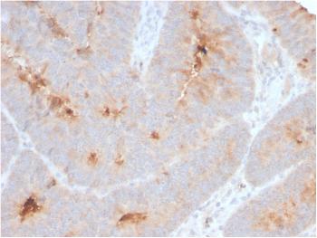 Anti-Secretory Component / ECM1 Monoclonal Antibody(Clone: ECM1/2889R)