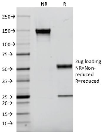 Anti-EGFR (Epidermal Growth Factor Receptor) Monoclonal Antibody(Clone: F4)