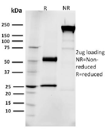 Anti-EGFR (Epidermal Growth Factor Receptor) Monoclonal Antibody(Clone: R1)