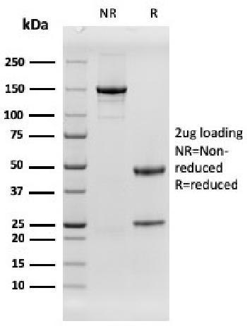 Anti-EGFR (Epidermal Growth Factor Receptor) Monoclonal Antibody(Clone: rGFR/1667)