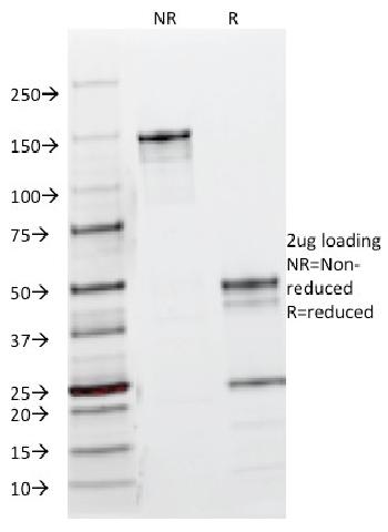 Anti-EGFR (Epidermal Growth Factor Receptor) Monoclonal Antibody(Clone: B1D8)