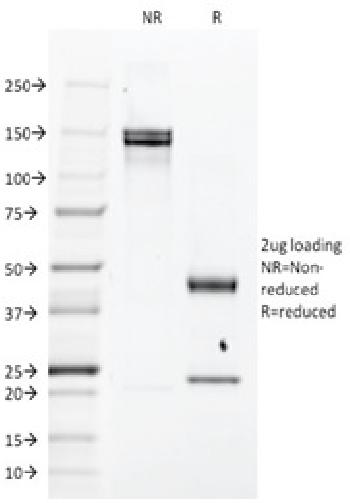 Anti-EGFR (Epidermal Growth Factor Receptor) Monoclonal Antibody(Clone: H9B4)