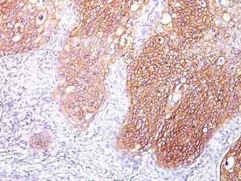 Anti-EGFR (Epidermal Growth Factor Receptor) Monoclonal Antibody(Clone: GFR/1667)