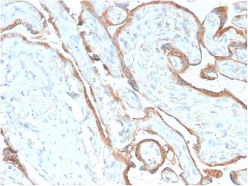 Anti-EGFR (Epidermal Growth Factor Receptor) Monoclonal Antibody(Clone: GFR/2968R)