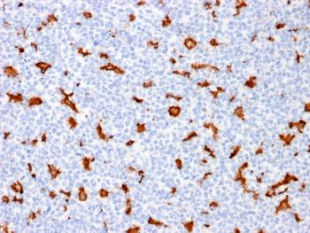 Anti-AIF1 / Iba1 (Microglia Marker) Monoclonal Antibody(Clone: AIF1/1909)