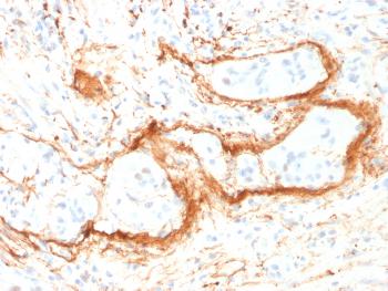 Anti-Elastin (ELN) (Marker of Arterial Stiffness and Atherosclerosis) Monoclonal Antibody(Clone: ELN/1981)