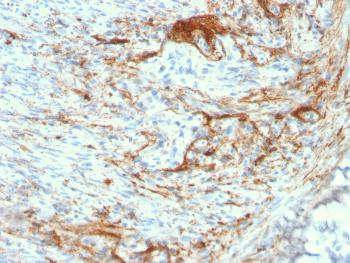 Anti-Elastin (ELN) (Marker of Arterial Stiffness and Atherosclerosis) Monoclonal Antibody(Clone: ELN/3131R)