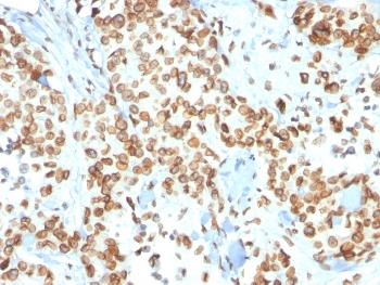 Anti-Emerin (Papillary Thyroid Carcinoma and EDMD Marker) Monoclonal Antibody(Clone: EMD/2167)