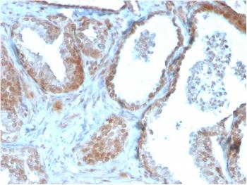 Anti-TIGIT / VSTM3 / VSIG9 (Immune Checkpoint for Cancer) Monoclonal Antibody(Clone: TIGIT/3106)