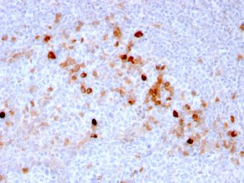 Anti-Endoglin / CD105 (Angiogenesis Marker) Monoclonal Antibody(Clone: ENG/3269)