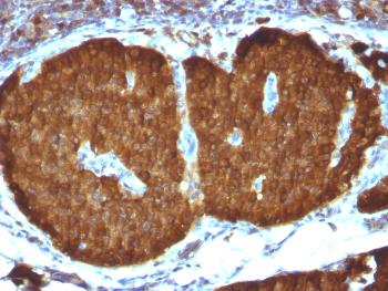 Anti-NSE gamma (Neuron Specific Enolase, gamma) (Neuroendocrine Marker) Monoclonal Antibody(Clone: ENO2/1375)