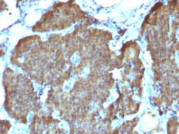 Anti-NSE gamma (Neuron Specific Enolase, gamma) (Neuroendocrine Marker) Monoclonal Antibody(Clone: SPM347)