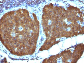 Anti-NSE gamma (Neuron Specific Enolase, gamma) (Neuroendocrine Marker) Monoclonal Antibody(Clone: ENO2/1462)